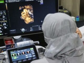 Beban Ekonomi Timbulkan Potensi Depresi Calon Dokter Spesialis, Pemberian Insentif Harus Dikaji